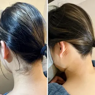 うなじ脱毛/美肌脱毛 LABELのエステ・リラクイメージ