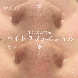 フェイシャルサロン CHIARA 荒田のエステ・リラクイメージ