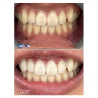 M渋谷店所属・Ｍ渋谷 ホワイトニングのエステ・リラクイメージ