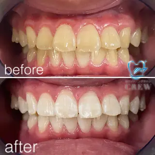 ネイル マツエク・マツパ アイブロウ ホワイトニング ⚓︎CREW柏⚓︎のその他イメージ