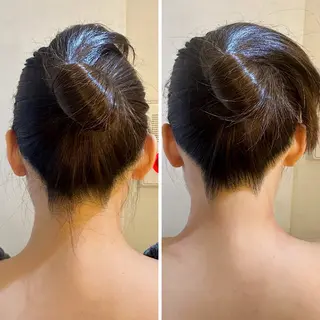 うなじ脱毛/美肌脱毛 LABELのエステ・リラクイメージ