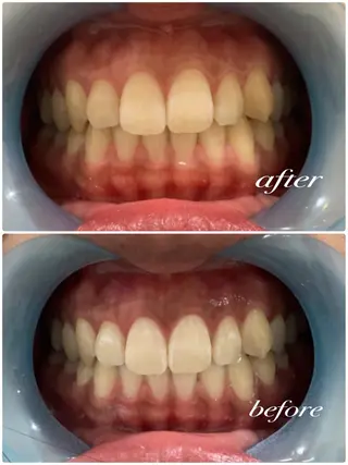 Whitening Diversのその他イメージ