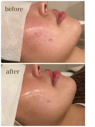 小顔×肌質改善サロン soin〔ソワン〕のエステ・リラクイメージ