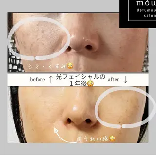 moudatumou salonのエステ・リラクイメージ