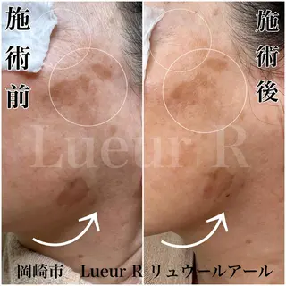 大久保 里奈のエステ・リラクイメージ