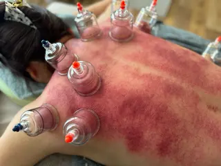 かっさ吸玉サロン Fluentのエステ・リラクイメージ