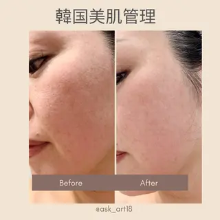 渡韓不要🇰🇷韓国 美肌管理＆眉のエステ・リラクイメージ