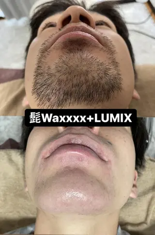 メンズ Epina 千葉店 【エピナ】のエステ・リラクイメージ