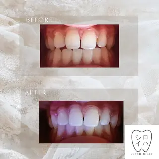 ホワイトニングサロン シロイハ所属・歯を白くしたい方🦷 シロイハのその他イメージ