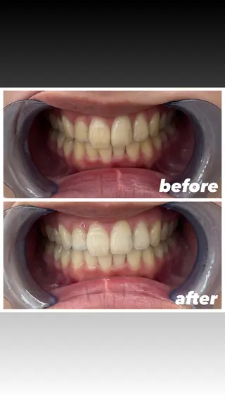 セルフホワイトニングエクシア小山店所属・セルフホワイトニング エクシア小山店のその他イメージ