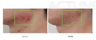 韓国肌管理🇰🇷 Mikiのエステ・リラクイメージ