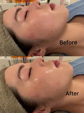 鍼灸サロン mahorobaトモのエステ・リラクイメージ