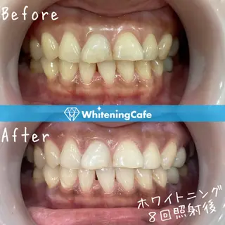 ホワイトニングカフェ徳島沖浜店所属・ホワイトニングカフェ 徳島沖浜店のエステ・リラクイメージ