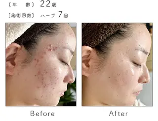 ハーブピーリング専門 BIOEL横浜のエステ・リラクイメージ