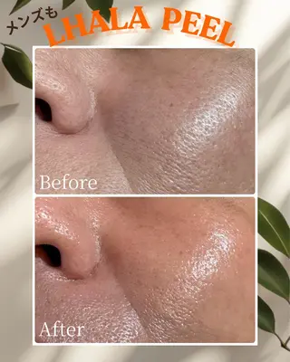 春日井/脱毛・エステサロン salon de AZURE所属・salon de AZUREのエステ・リラクイメージ