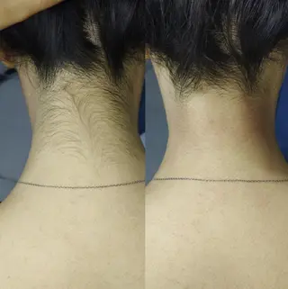 最新マシーン氣顔 REBORN幸田のエステ・リラクイメージ