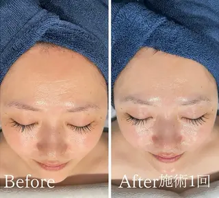 アンド ミルルのエステ・リラクイメージ