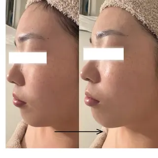 POLA THE BEAUTY 天王寺店所属・UEDA | POLA 天王寺のエステ・リラクイメージ