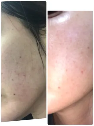 トータルエステサロン Tiaraのエステ・リラクイメージ