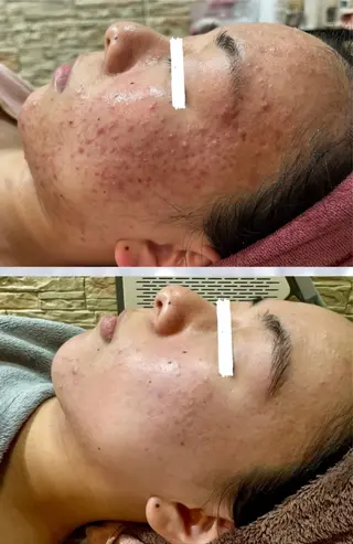 エレファンテブランコ所属・エレファンテブランコ yukariのエステ・リラクイメージ