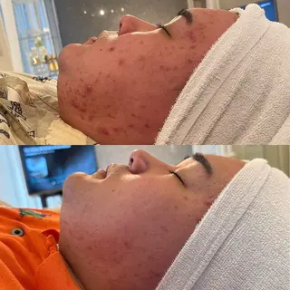 素肌キレイLab.所属・≪ニキビケア≫ 素肌キレイLab.のエステ・リラクイメージ