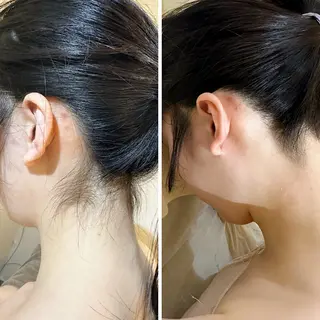 うなじ脱毛/美肌脱毛 LABELのエステ・リラクイメージ