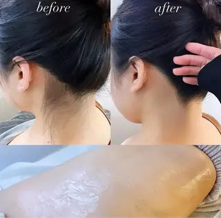 うなじ脱毛/美肌脱毛 LABELのエステ・リラクイメージ