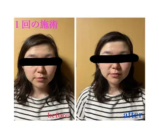 アロマ･美容鍼･カッ ピング「麗」鍼灸院のエステ・リラクイメージ