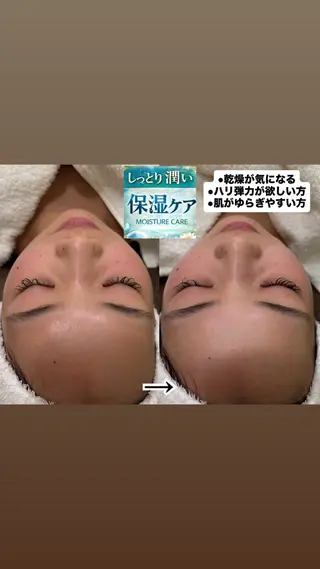 aroma  YURARI所属・韓国艶美人// 毛穴ケア🌹のエステ・リラクイメージ