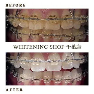 メンズ ホワイトニング ショップ千葉店のその他イメージ