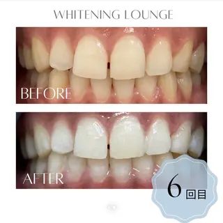 ホワイトニングラウンジ横須賀所属・ホワイトニング Lounge横須賀のその他イメージ