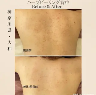 knoté 🦋Nittaのエステ・リラクイメージ