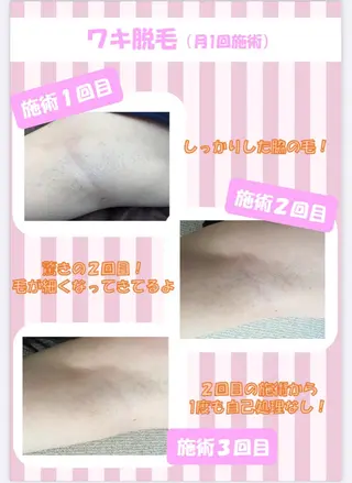 脱毛＆エステサロン・ド・ユマン所属・脱毛&エステ サロン・ド・ユマンのエステ・リラクイメージ