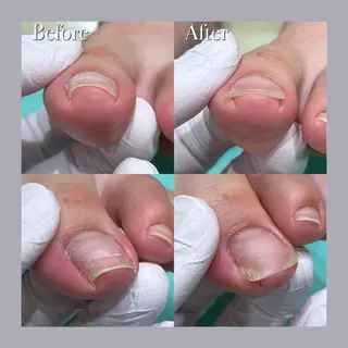 巻き爪補正店 大阪天王寺店のネイルデザイン