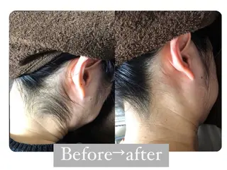 都度払い脱毛サロン Remiraのエステ・リラクイメージ