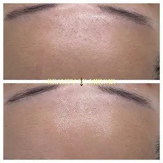 ビューティー ミロワールのエステ・リラクイメージ