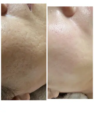 トータルエステサロン Tiaraのエステ・リラクイメージ