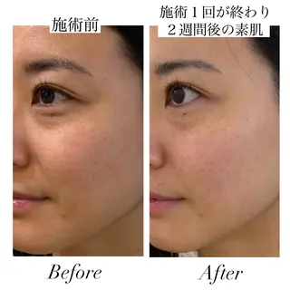 【Salon D】 HALUのエステ・リラクイメージ