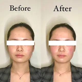 Hari Lounge恵比寿所属・chika🦋 ハリラウンジ恵比寿のエステ・リラクイメージ