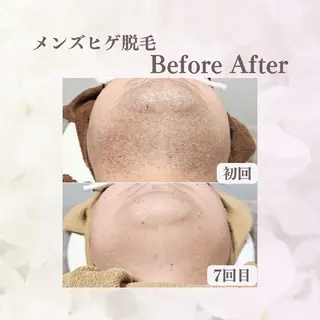 Iryアイリー所属・Iry アイリーのエステ・リラクイメージ