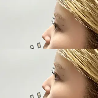 マツエク・マツパ 、 alaのマツエク・マツパデザイン