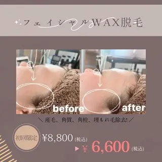 MEGURU所属・篠原 由紀野のエステ・リラクイメージ