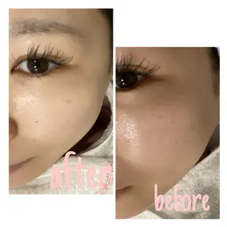 アルカンジュ~archange~所属・痩身/毛穴洗浄/脱毛 アルカンジュのエステ・リラクイメージ