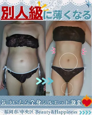 痩身ハーブピーリング 筋膜リリース☆B&Hのエステ・リラクイメージ