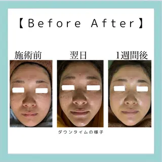 ネイル&エステ phuan(プアン)のネイルデザイン