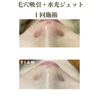 美肌サロンTIAM by tetoteのエステ・リラクイメージ