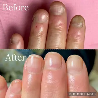 ネイル 深爪・自爪育成専門 MAHALOHIのネイルデザイン