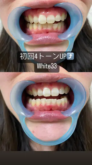 メンズ セルフホワイトニング White33大名のその他イメージ