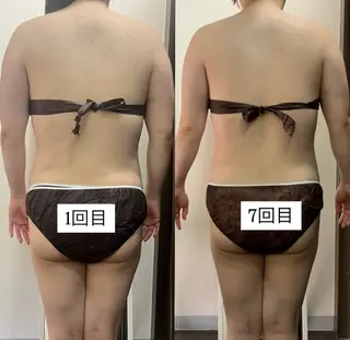 ハイパーナイフ専門店 Salon de COCO所属・Salon de COCOのエステ・リラクイメージ