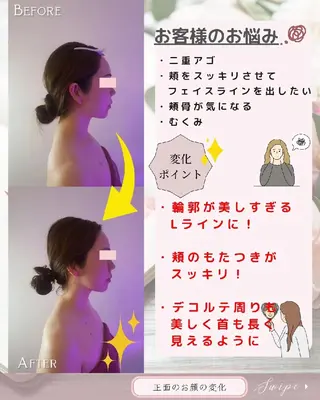 痩身ハーブピーリング 筋膜リリース☆B&Hのエステ・リラクイメージ